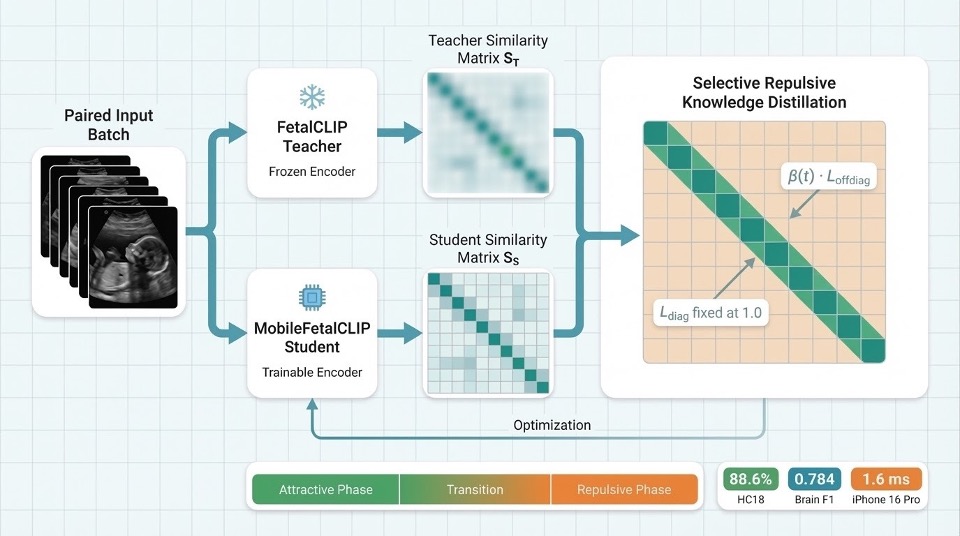 MobileFetalCLIP method overview showing paired ultrasound inputs, frozen teacher and trainable student encoders, teacher and student similarity matrices, selective repulsive knowledge distillation, and the attractive-to-repulsive phase schedule